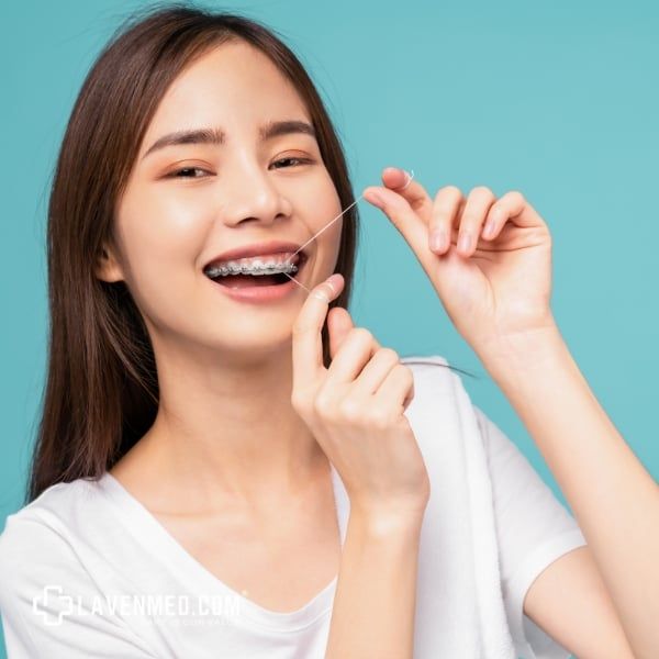 Niềng răng là một quá trình quan trọng để cải thiện sức khỏe răng miệng và thẩm mỹ của bạn.