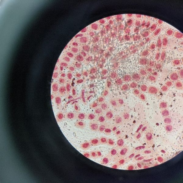 ba hệ quan trọng là hệ hoóc môn, hệ thần kinh, hệ miễn dịch như ba chân của một chiếc kiềng.