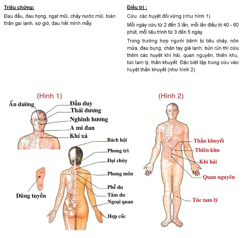 Cảm Mạo Phong Hàn: Phương Pháp Điều Trị Bằng Cứu Ngải