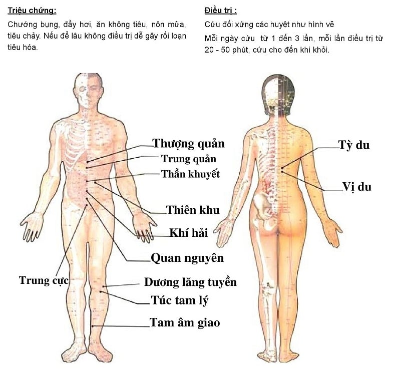 Hướng dẫn cứu ngải chữa Đau bụng đầy hơi do bị nhiễm lạnh - Máy cứu ngải Maxonga