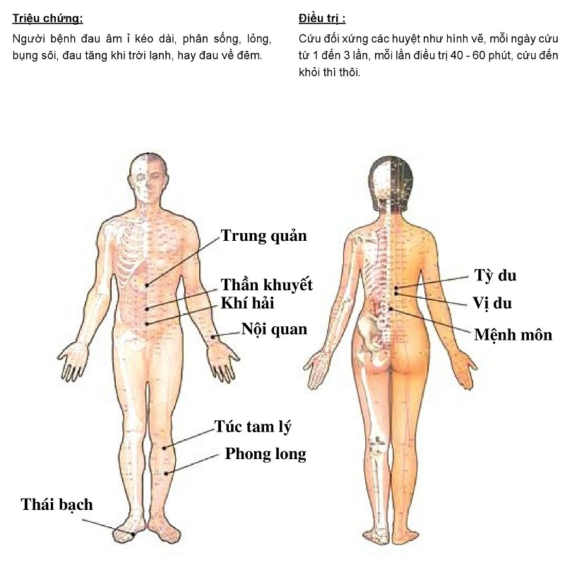 Cứu ngải chữa Đau dạ dày bằng Máy cứu ngải Maxonga