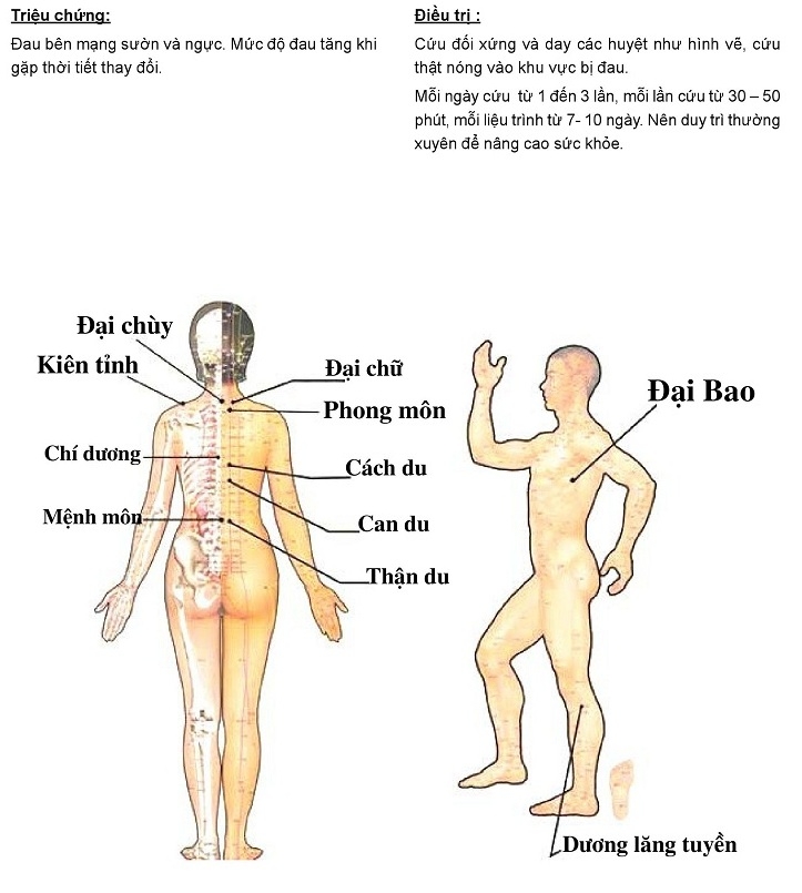 Hướng dẫn cứu ngải chữa đau dây thần kinh liên sườn - Máy cứu ngải Maxonga