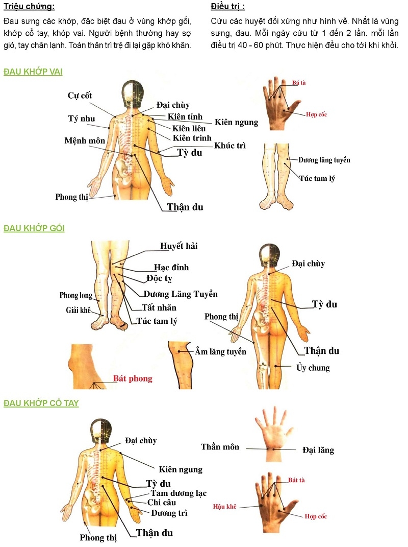 Cứu ngải chữa đau khớp vai, đau khớp gối, đau khớp cổ tay