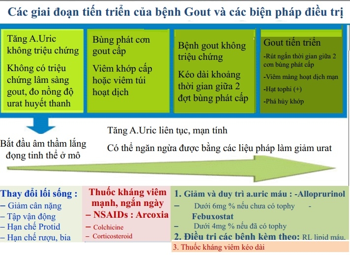 Điều Trị Viêm Khớp Gout