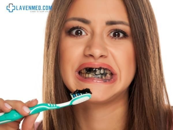 Kem đánh răng than hoạt tính được quảng cáo nhiều trong làm trắng răng
