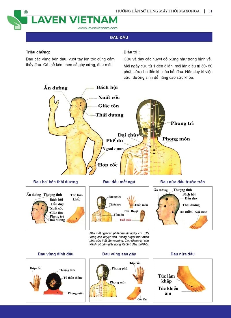 Ứng dụng dùng Máy cứu ngải trong điều trị bệnh Đau Đầu