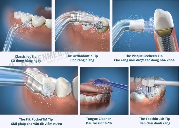 Tính năng của các đầu tăm nước phổ biến trên thị trường