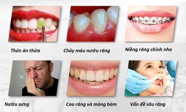 Những nguy cơ sức khỏe răng miệng thường gặp