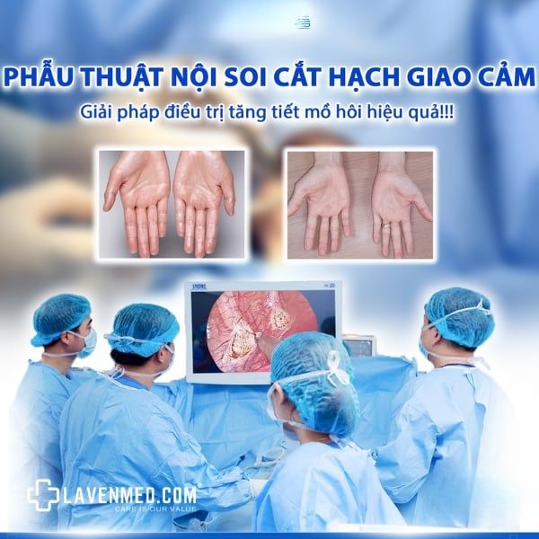 Phương pháp phẫu thuật cắt hạch giao cảm được áp dụng nhiều trên hệ thống các bệnh viện đa khoa lớn