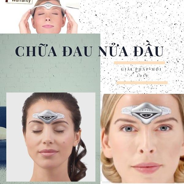 Phương pháp chữa đau nửa đầu Migraine bằng thiết bị Cefaly mới được Mỹ công nhận và áp dụng nhiều trên toàn thế giới