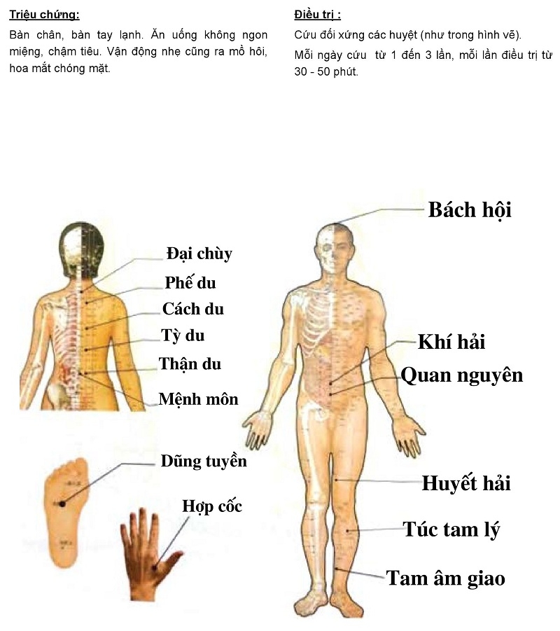 Chữa Suy Nhược Cơ Thể Bằng Phương Pháp Cứu Ngải