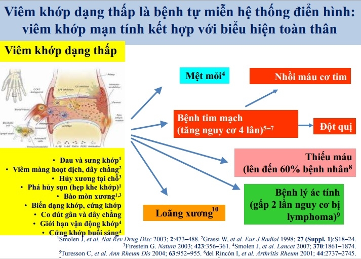 Điều Trị Viêm Khớp Dạng Thấp