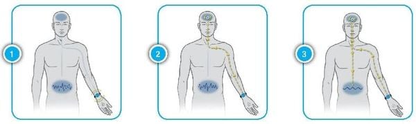 Nguyên lý hoạt động của Vòng đeo tay Reliefband chống say tàu xe ốm nghén tiền đình