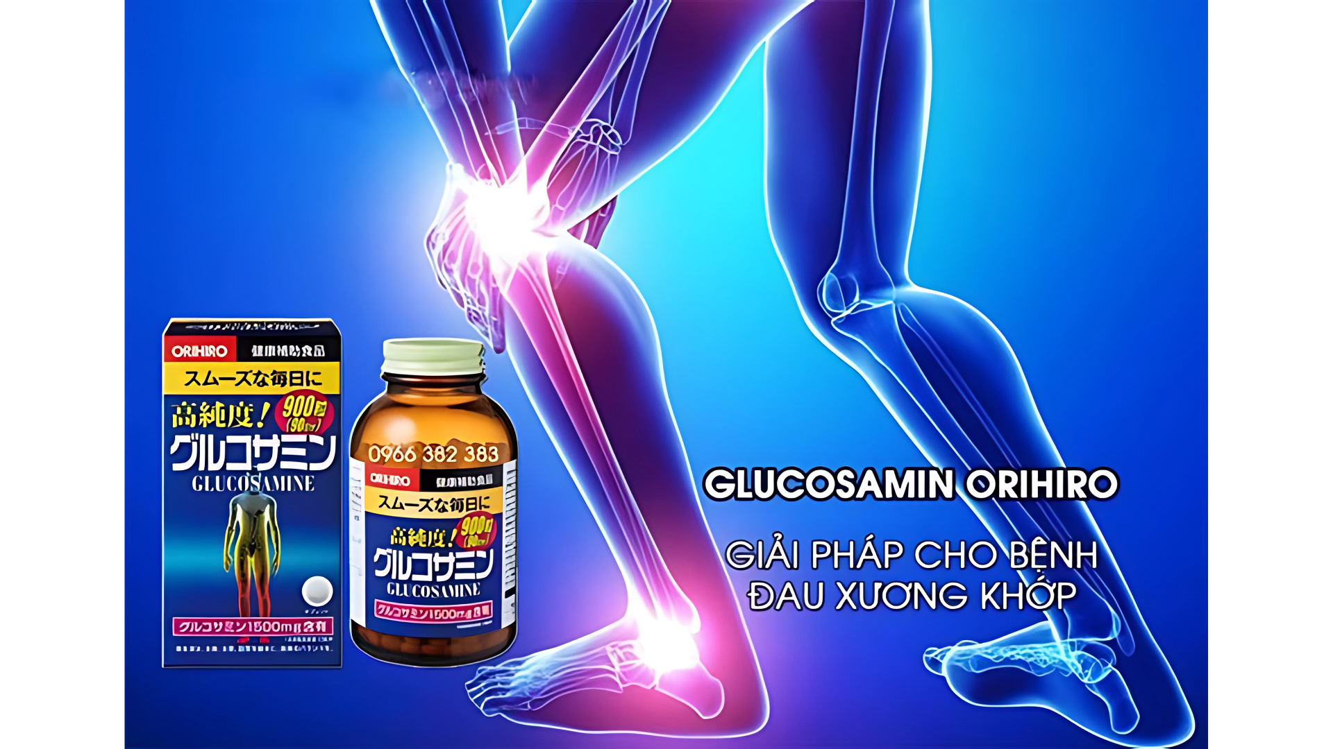 Bổ sung Glucosamin