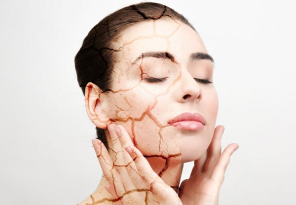 Cách trị da khô nứt nẻ tại nhà với 8 nguyên liệu tự nhiên hiệu quả cao