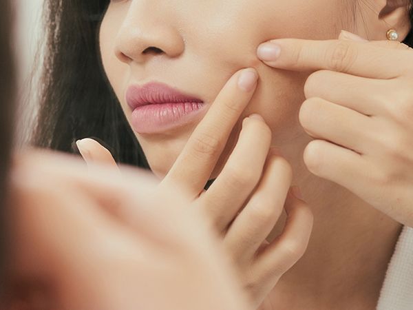 Lý giải vì sao uống DHC vitamin C bị nổi mụn và hướng dẫn sử dụng