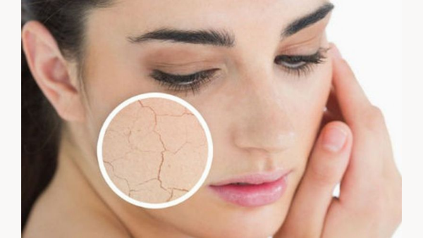 Cồn khô có thể dẫn đến làm khô, gây kích ứng
