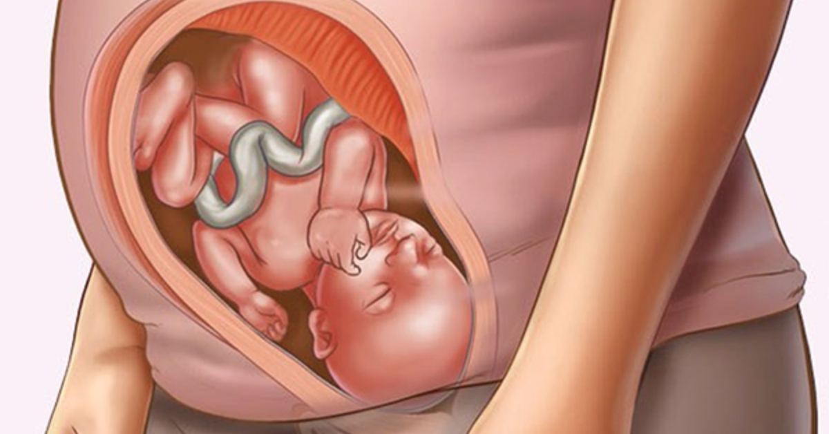 Hỗ trợ giảm nguy cơ dị tật bẩm sinh