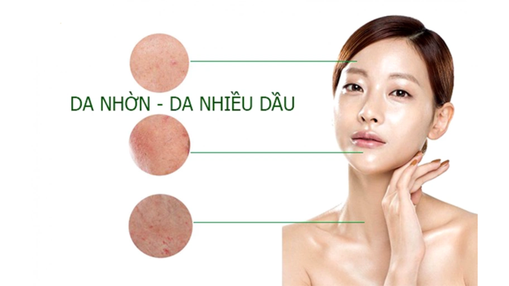 Chị em có làn da dầu nên chọn nước hoa hồng dưỡng ẩm dịu nhẹ