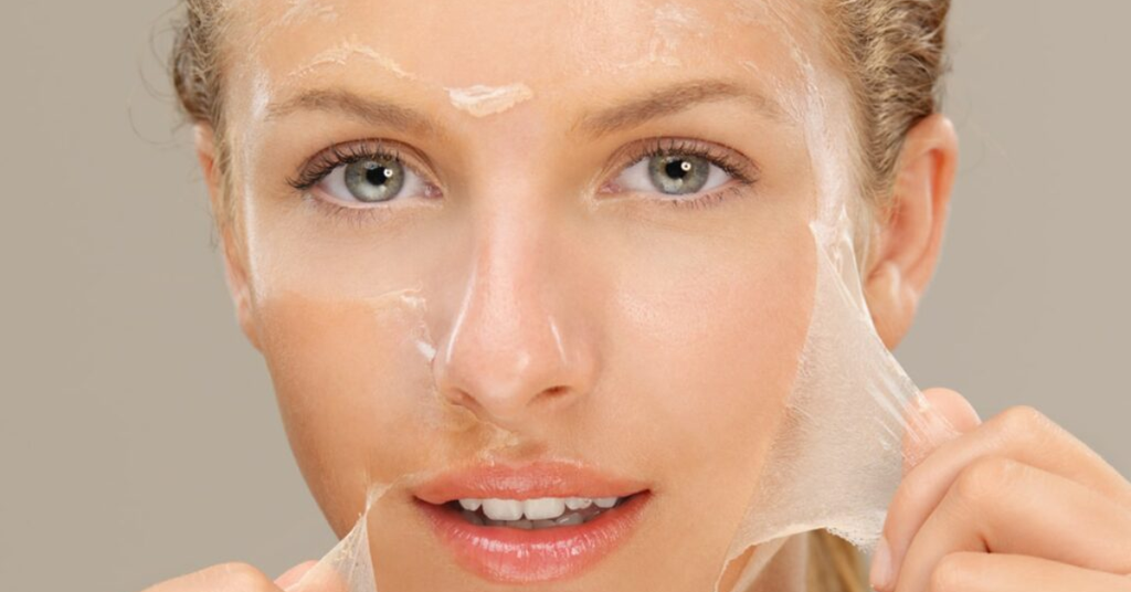 Tái tạo collagen bằng phương pháp peel da hóa học