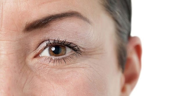 dấu hiệu lão hóa trên mắt