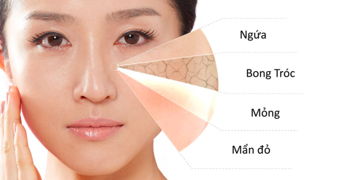 Đối với phụ nữ mang thai làn da trở nên nhạy cảm và dễ tổn thương hơn