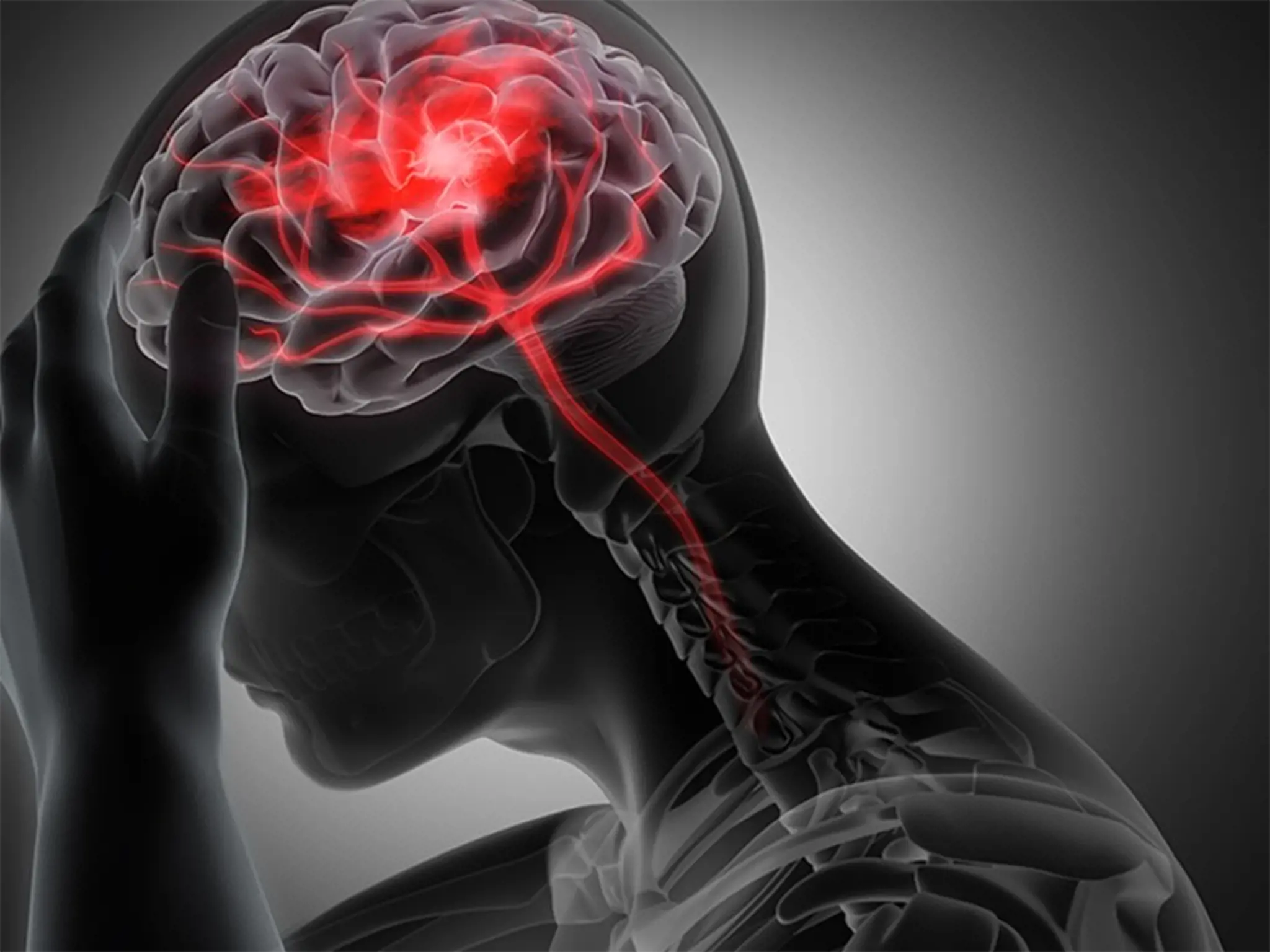 Nhồi máu não: Triệu chứng, nguyên nhân và cách phòng ngừa