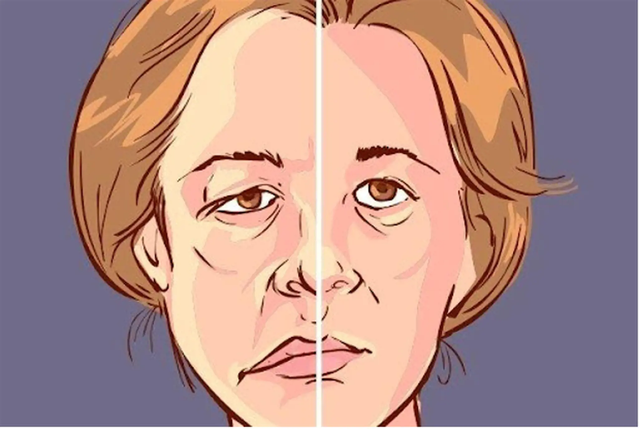 Liệt nửa người là gì? Nguyên nhân và cách điều trị liệt nửa người