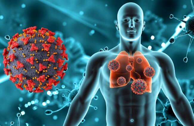 Ung thư phổi giai đoạn 4 là gì?