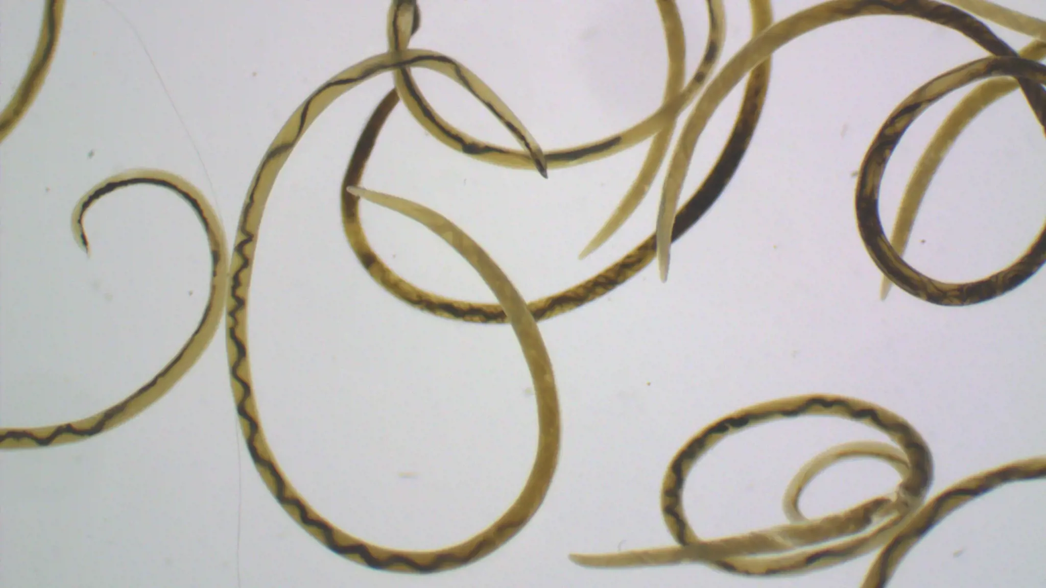 Bệnh Angiostrongyliasis: Nguyên nhân, triệu chứng và điệu trị