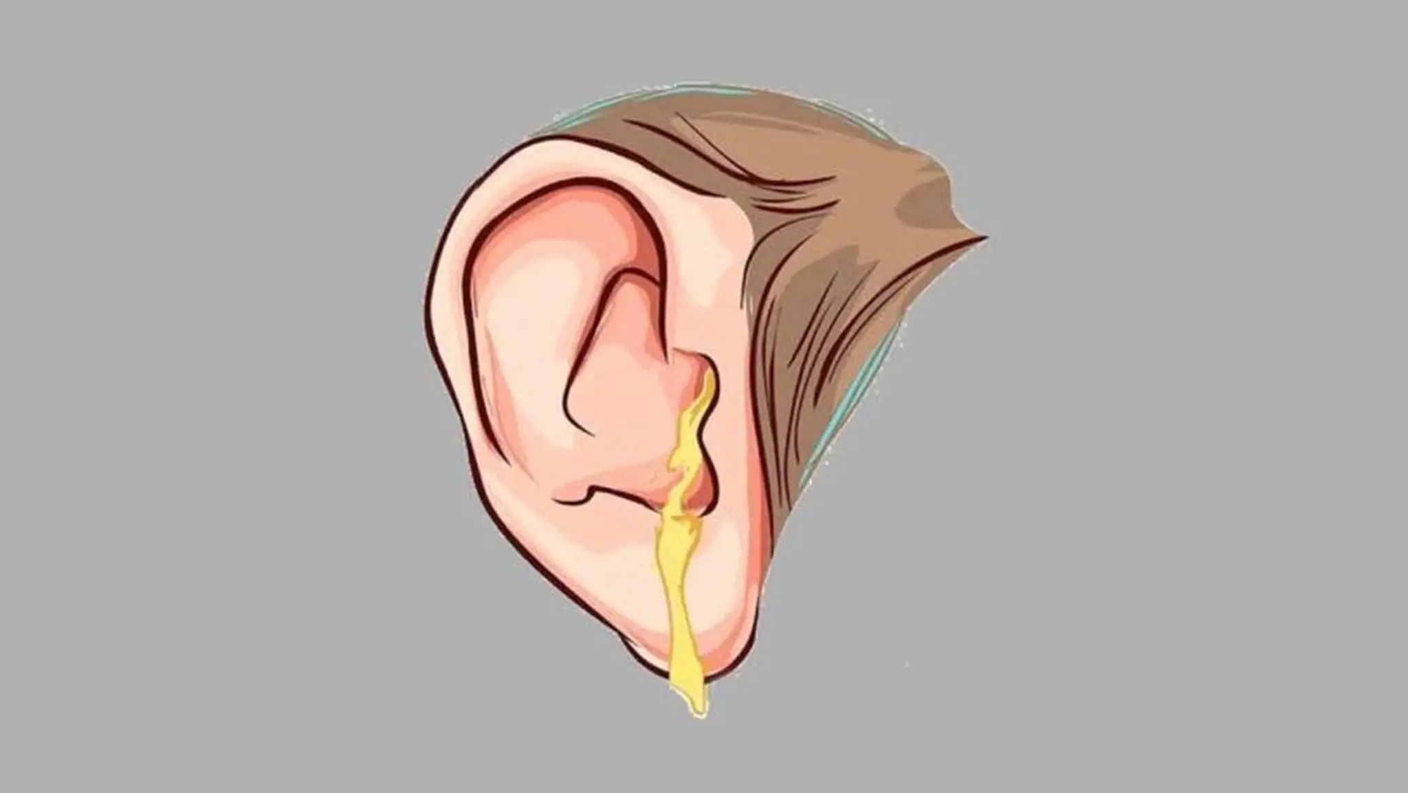 Chảy dịch tai là gì? Có nguy hiểm không? Cách điều trị và phòng ngừa