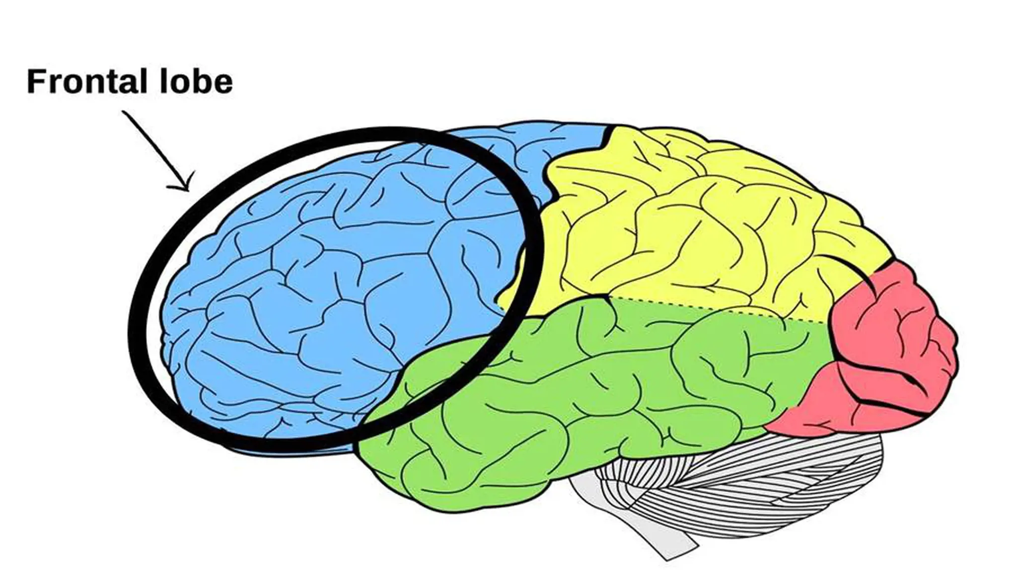 Động kinh thùy trán là gì? Những thông tin bạn cần biết về động kinh thùy trán