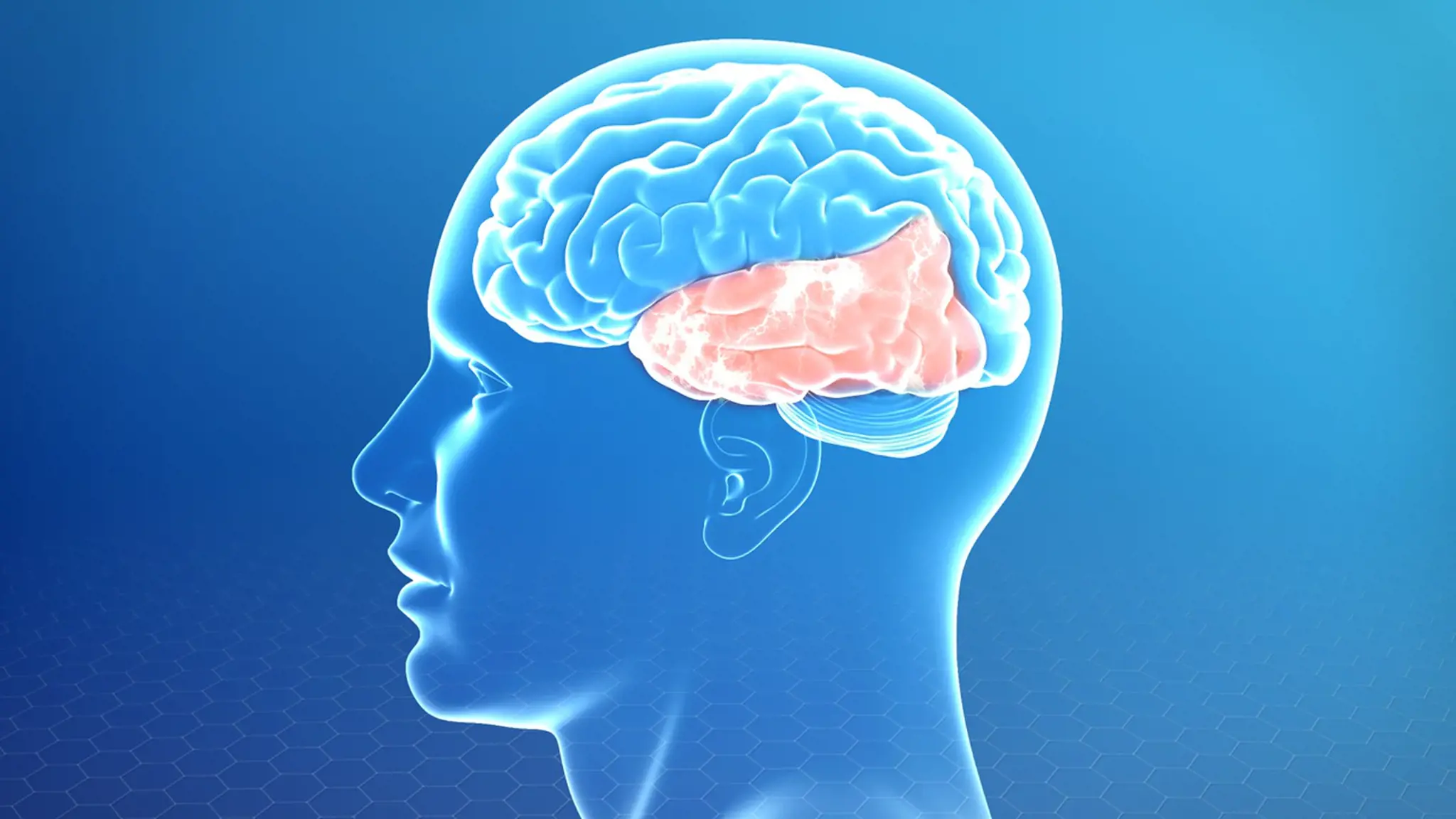 Động kinh thuỳ thái dương là gì? Những điều cần biết về động kinh thuỳ thái dương