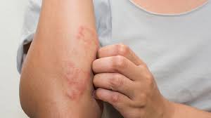 Chi phí xét nghiệm bệnh xã hội bao nhiêu tiền?