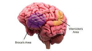Chứng mất ngôn ngữ và những điều cần biết