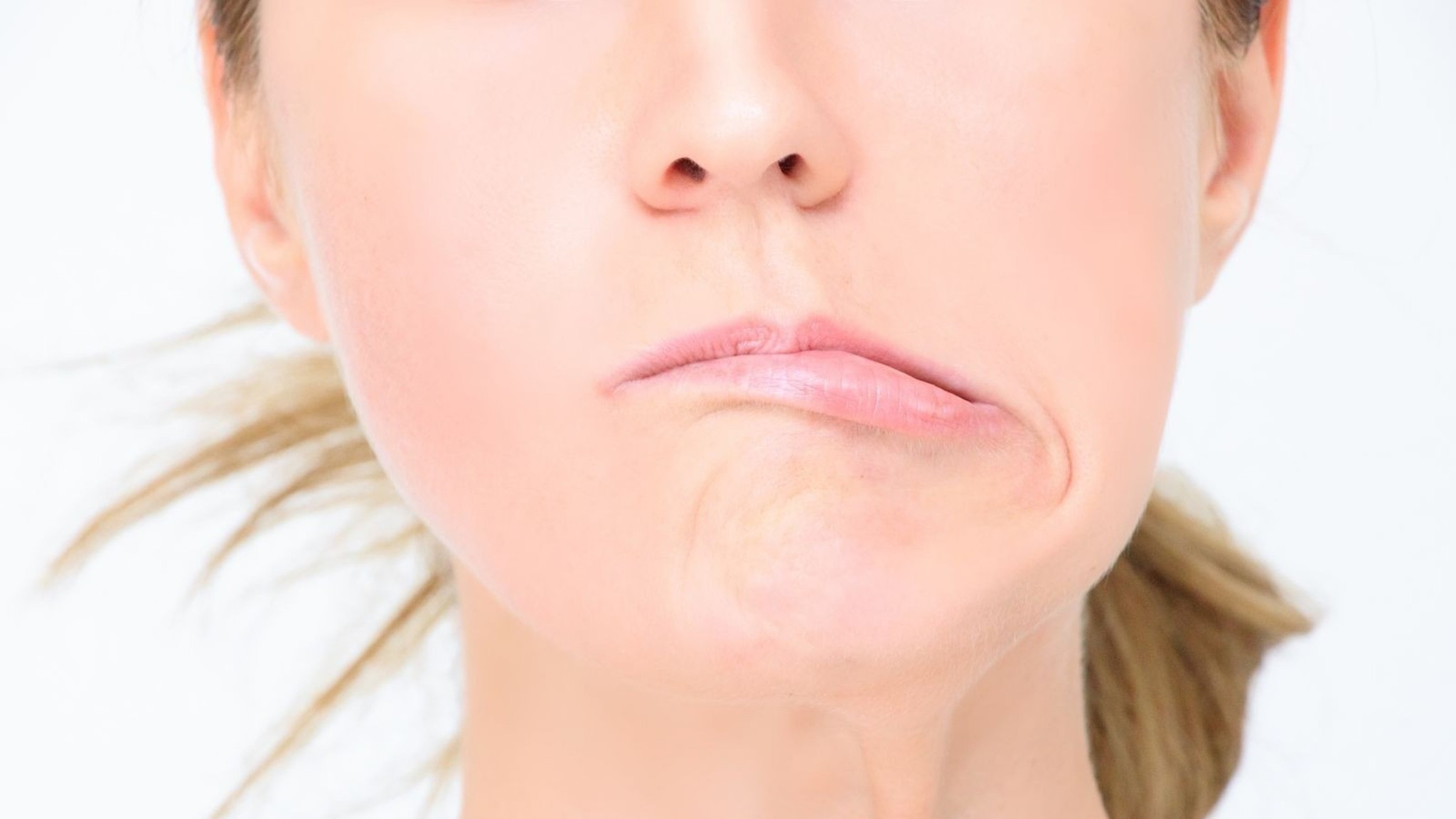 Tại sao bạn mắc bệnh liệt mặt? Cách phòng ngừa và điều trị