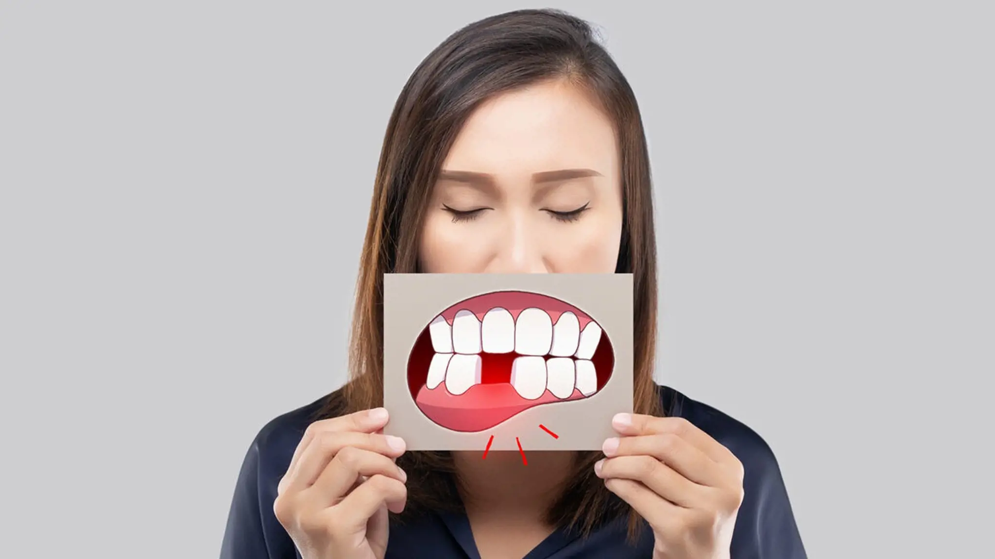 Mất răng là gì? Những vấn đề cần biết về mất răng và cách bảo vệ răng sau khi mất răng