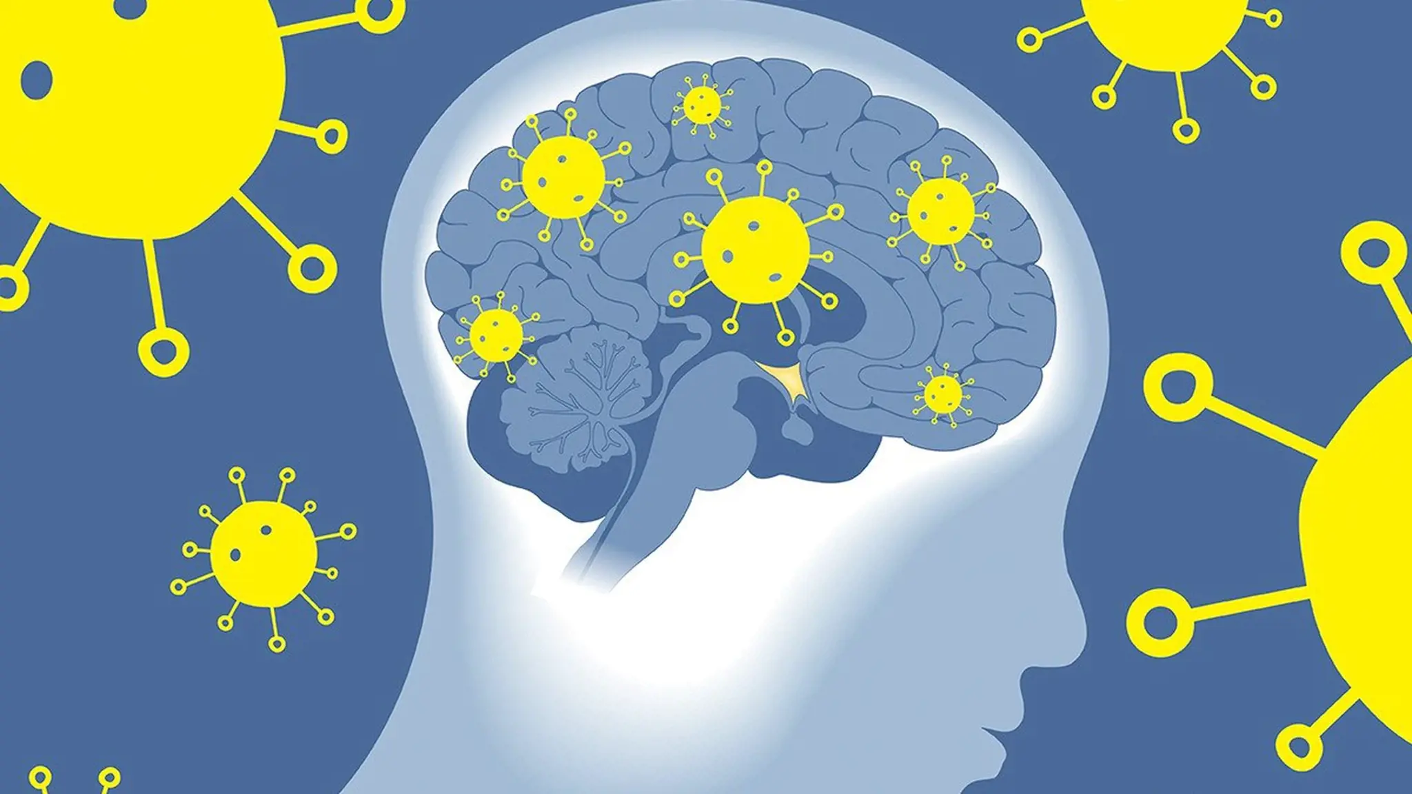 Nhiễm trùng thần kinh là bệnh lý gì? Dấu hiệu, nguyên nhân và cách phòng ngừa