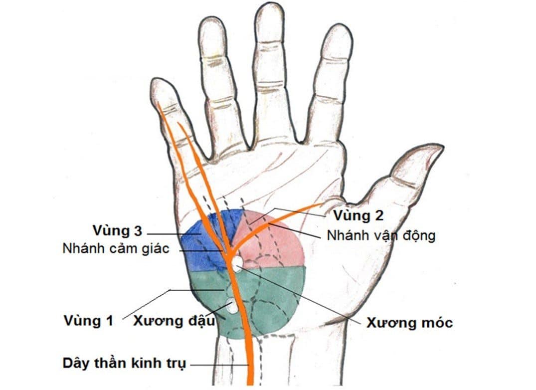 Rối loạn dây thần kinh trụ là gì? Những điều cần biết về rối loạn dây thần kinh trụ