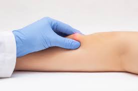 Góc giải đáp thắc mắc: Khám u mỡ ở bệnh viện nào tại Hà Nội?