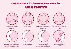 Ung thư vú giai đoạn 3: Triệu chứng và cách điều trị