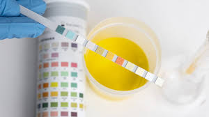 Xét nghiệm nước tiểu bao nhiêu tiền? Khi nào cần thực hiện xét nghiệm nước tiểu?