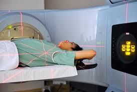 Xạ trị ung thư tuyến giáp và trọn bộ thông tin cần biết