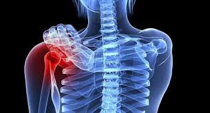 Ung thư xương và trọn bộ thông tin cần biết