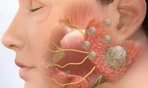 Cẩm nang sức khỏe về ung thư tuyến nước bọt