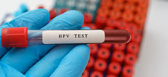 Xét nghiệm HPV ở đâu TPHCM? Địa chỉ uy tín và quy trình chi tiết bạn cần biết