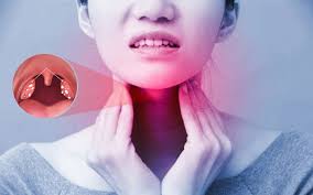 Những địa chỉ khám amidan tốt nhất tại TP.HCM