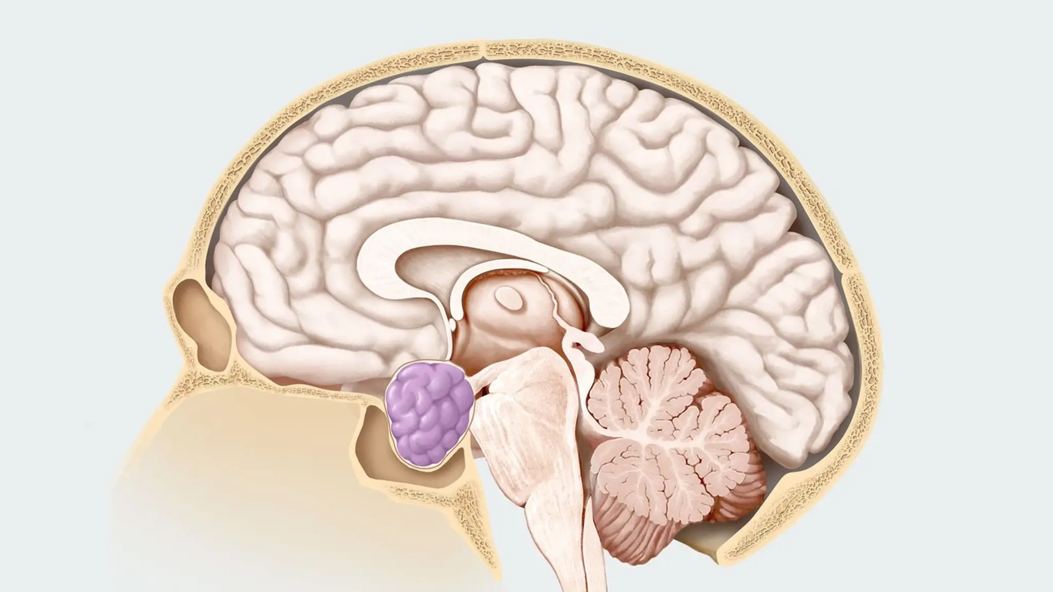 U tuyến yên là bệnh gì? Có nguy hiểm không?
