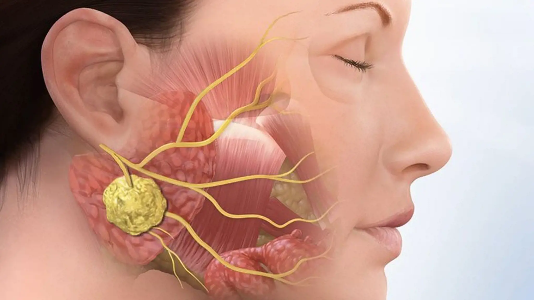 Ung thư xương hàm: Nguyên nhân, triệu chứng và phương pháp điều trị