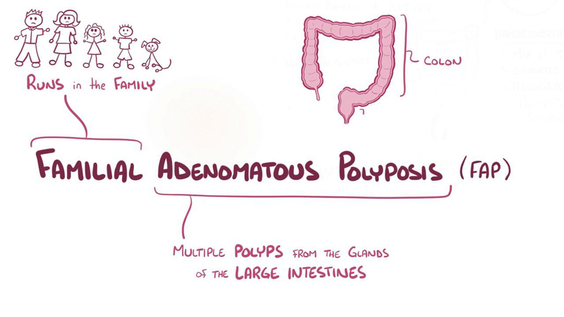 Tìm hiểu chung ung thư đại tràng giai đoạn 1